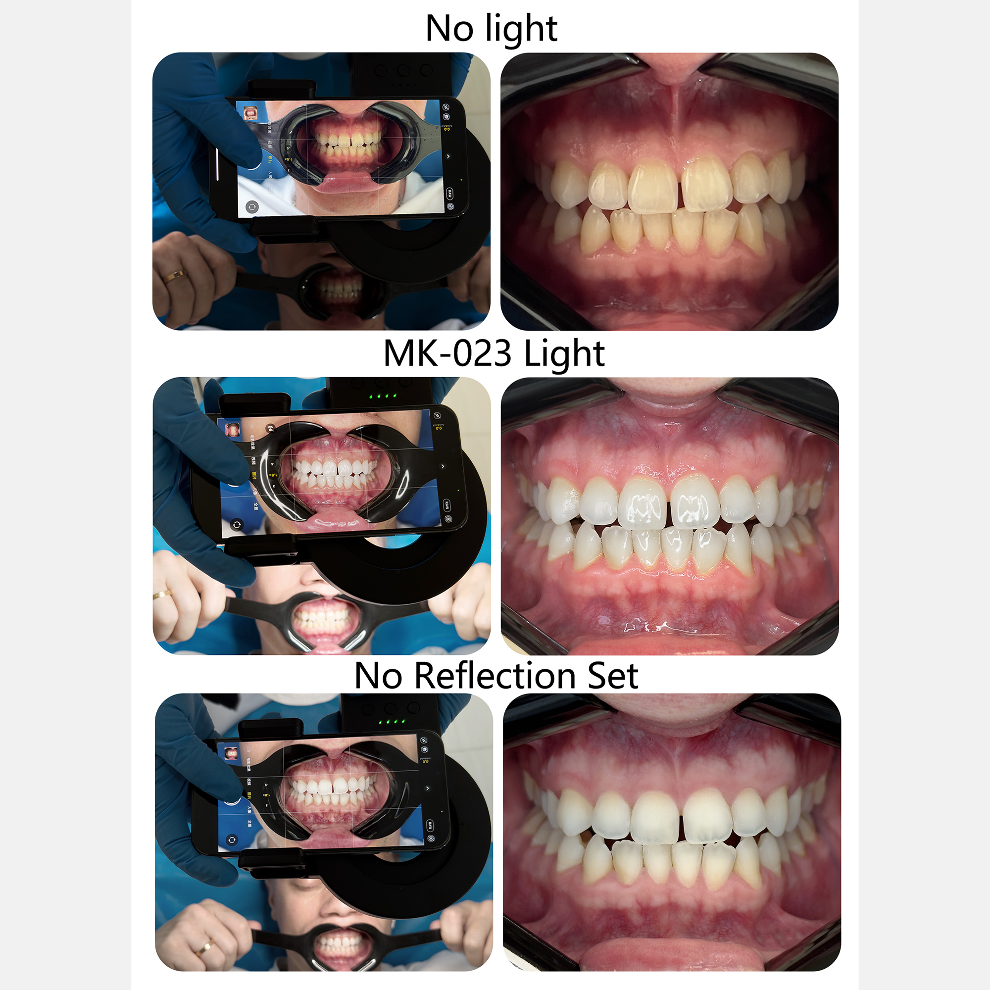 HERA MK-23 Intraoral Dental Ph – обзор и цена Photography Lighting Ring