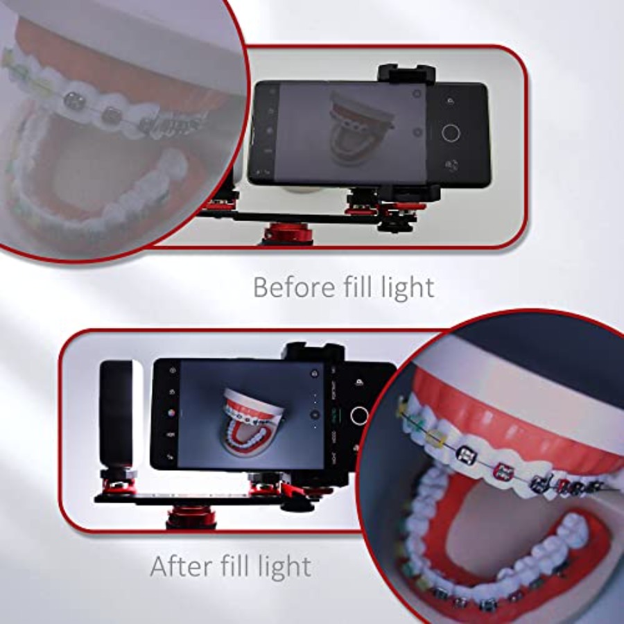 Bluetooth Dental Flash Light P – обзор и цена Photography Lighting Led
