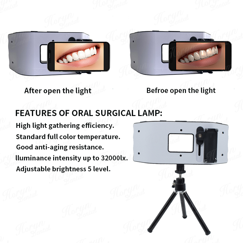 Dental Flash Light Photography – обзор и цена Photography Lighting Led